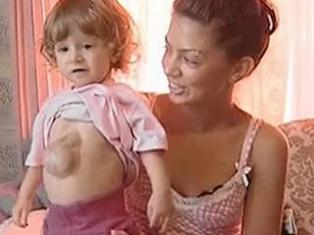 Armenian baby girl’s heart beats not in chest but abdomen: Special report (video