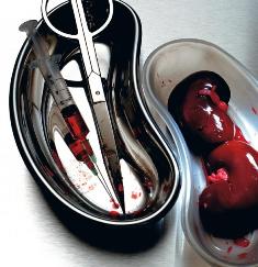 Azeri authorities fail to conceal illegal transplantation