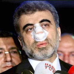 Թուրք նախարարին բռունցքով հարվածած անձը հիմա էլ Էրդողանի դեմ անեկդոտ 
պատմելու
