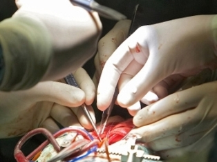 ОБСЕ: Жертвами косовских трансплантологов стали граждане России, Украины и Белар