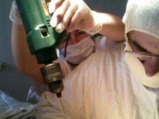 Молдавские хирурги оперировали детей бытовой дрелью