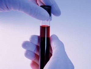 Ученым удалось создать искусственную кровь