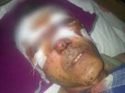 US condemns beating of Azerbaijani journalist