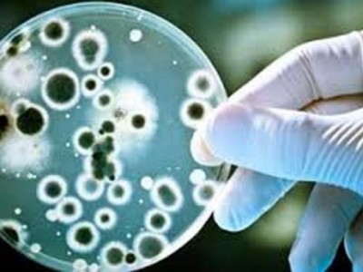 По факту заражения людей бруцеллезом возбуждено уголовное дело