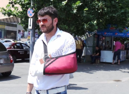 Հեռուստասերիալի դերասանը Ծաղկաձորում վայր է ըկել ձիուց եւ վնասվածք ստացել. Shamshyan.com (ֆոտո)