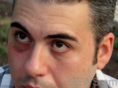 Վահան Մարտիրոսյանին ծեծի ենթարկելու դեպքով քրգործ հարուցվեց