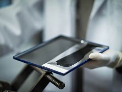 Armenia scientist patents cost effective and ecologic method of getting ‘material of future’