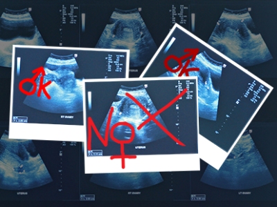 Italian newspapers: Armenia is 2nd country in the world according to sex-selective abortions