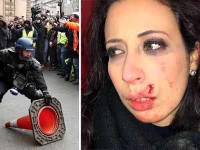 На протестах в Париже ранили в лицо корреспондента RT France