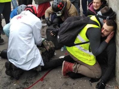 В Париже участнику акции «жёлтых жилетов» взрывом гранаты оторвало кисть руки