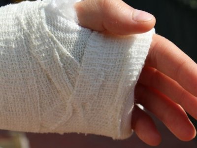 В Словении женщина отпилила себе руку, чтобы получить страховку
