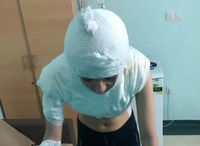 Թուրքիայում խորթ մայրը եռացրած ջուրը լցրել է աղջկա վրա