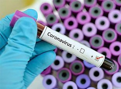 Уже 15: министр здравоохранения Армении сообщил еще о двух зараженных коронавирусом