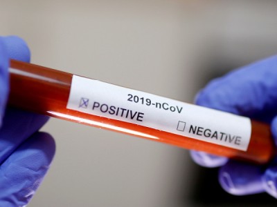Girl, 2, diagnosed with coronavirus in Kazakhstan