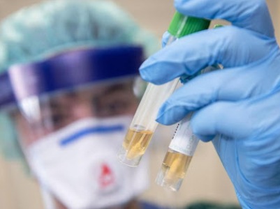 CNN: The US has the world's most confirmed COVID-19 cases