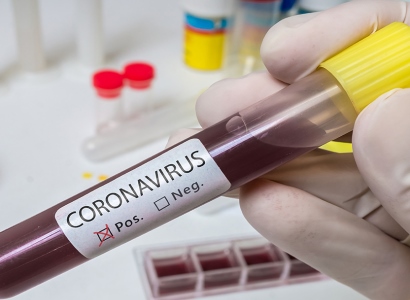Turkish health minister reports rise in number of coronavirus cases
