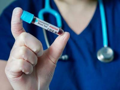 Another Armenia soldier diagnosed with coronavirus