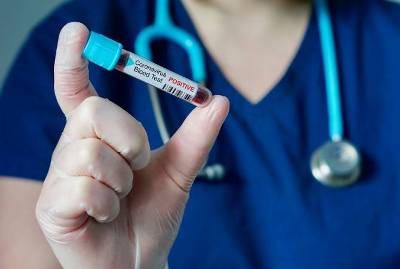 Newspaper: Coronavirus patients in Armenia give inaccurate information to Ministry of Health