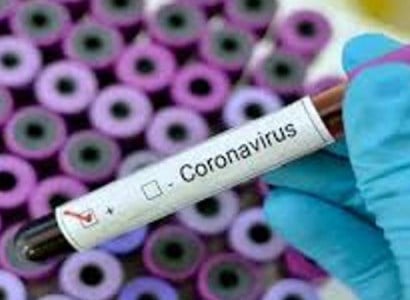 PM: Armenia to start production of COVID-19 tests