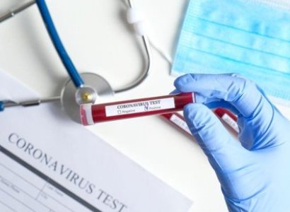 Yerevan Municipality's garbage collection company employee infected with COVID-19
