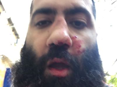 Advocate: Armenian authorities will use case of attack on Artur Danielyan against him