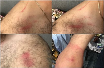 Подвергнутый приводу в полицию по ошибке житель Каджарана подвергся также насилию