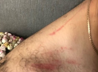 Предпринято служебное расследование по случаю применения насилия к гражданину в полиции Капана