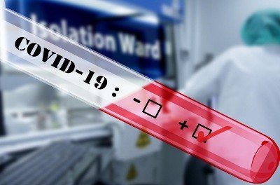 Армения оказалась на шестом месте в мире по количеству новых случаев заражения коронавирусом на 1 млн. жителей