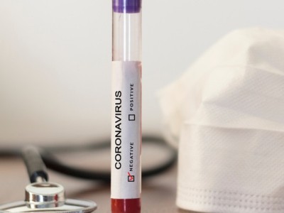 289 people in Armenia are infected with COVID-19 in one day