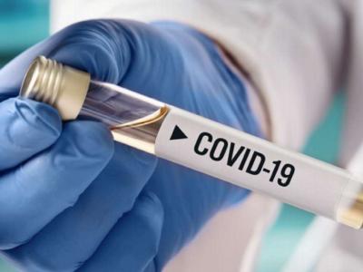 373 people in Armenia infected with COVID-19 in one day, 12 new deaths reported