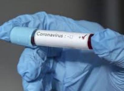 271 COVID-19 patients in Armenian are in severe condition