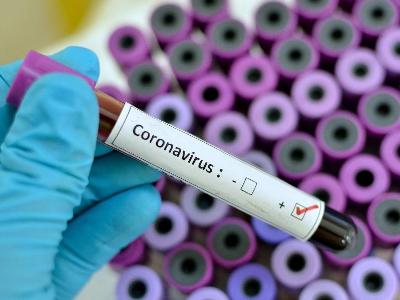 Nanny from Yerevan orphanage tests positive for COVID-19