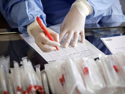460 new COVID-19 cases in Armenia in one day, 8 new deaths reported