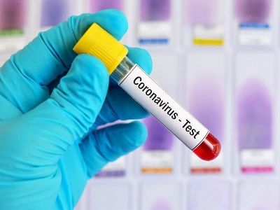 Media: Iran's scientists develop test system to detect COVID-19 in 55 minutes