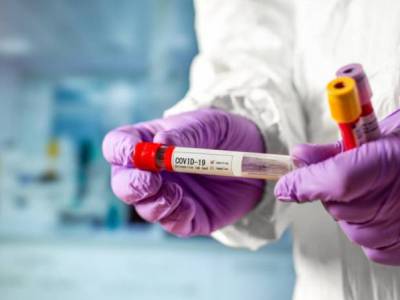 Record number of 771 new COVID-19 cases reported in Armenia, 12 new deaths 1 of which from another disease