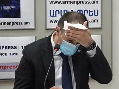 Ու տես, իմ առողջապահության չեղած նախարարության ղեկավար, քրտնեցիր 3-րոպեում, ու դիմակն էլ խոնավացավ. բժիշկ Մանասյան