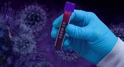 577 new COVID-19 cases reported in Armenia, 8 new deaths 2 of which from other diseases