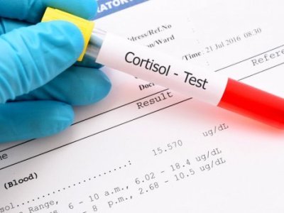 One new case of coronavirus confirmed in Karabakh