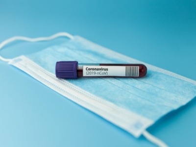308 new cases of COVID-19 reported in Armenia, 6 new deaths 2 of which from other diseases