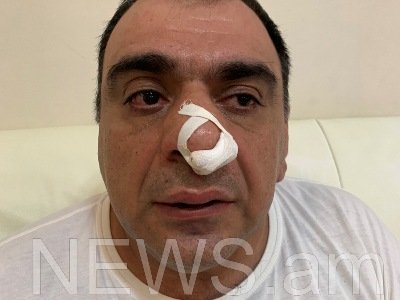 Խաչատուր Սուքիասյանին պատկանող գրասենյակում մոսկվաբնակ գործարարին ծեծելու դեպքով քրգործ է հարուցվել
