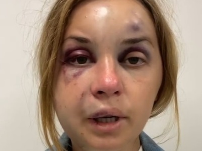 В поезде «Мариуполь-Киев» украинскую ведущую избили и пытались изнасиловать на глазах у сына