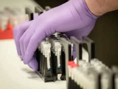 166 new cases of COVID-19 reported in Armenia, 5 more deaths