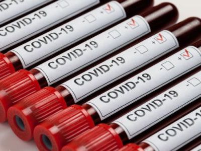 23 new cases of COVID-19 reported in Armenia, 5 more deaths