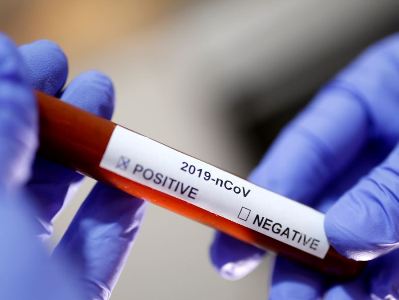 8 new COVID-19 cases reported in Georgia