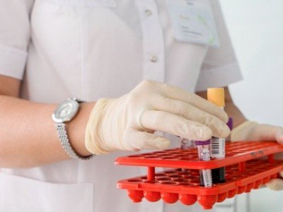 174 new cases of COVID-19 confirmed in Armenia
