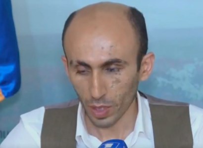 1 child, 7 women, and 11 men die in Artsakh amid Azerbaijani aggression