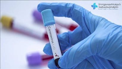 Коронавирус в Армении:  подтверждено  715 новых случаев, скончались 4 человека