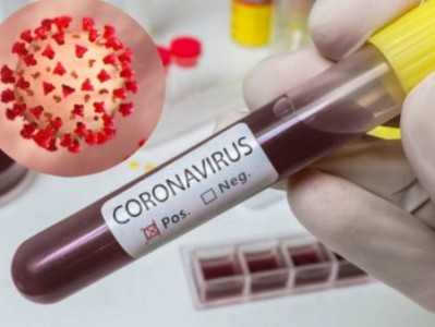 2,383 new cases of COVID-19 confirmed in Armenia