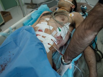 Armenia MFA spokesperson: Karabakh medics working under Azerbaijan bombing (PHOTOS)