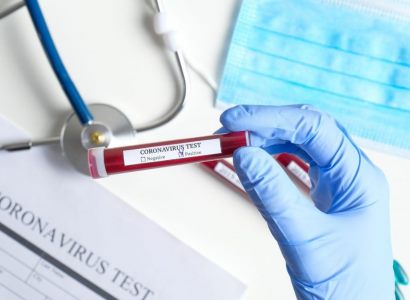 Armenia confirms 1,482 new coronavirus cases, 27 deaths from COVID-19